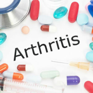 Arthritis – Classification and treatment