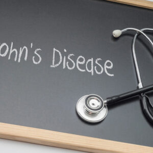 Symptoms, Types, and More About Crohn’s Disease
