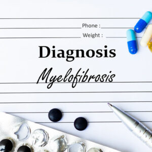 Myelofibrosis – Symptoms, causes, and management options