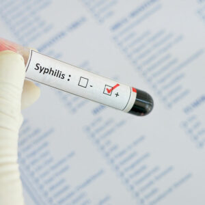 Syphilis – Early Signs and Diagnosis